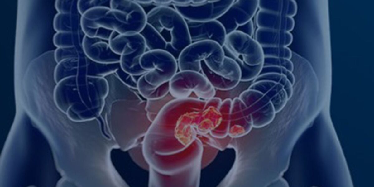 rss featured 19395 1773992240