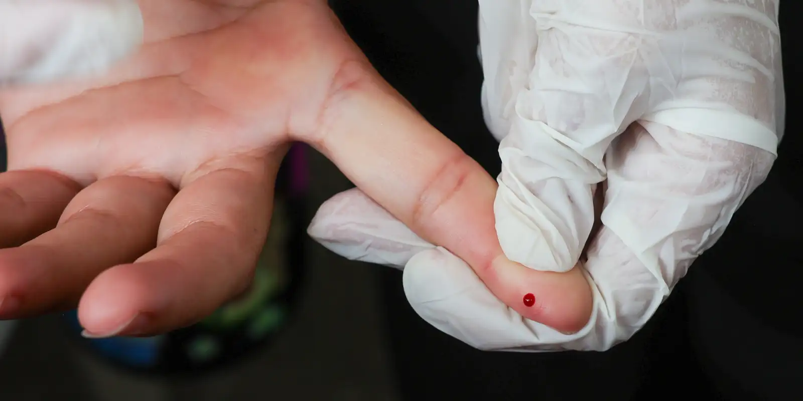 SUS Oferece Teste Rápido de Dengue para Diagnóstico Ágil 1 rss featured 19811 1774545714