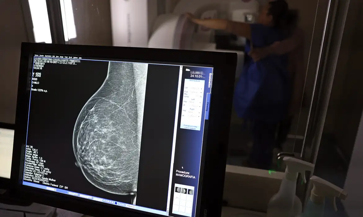 Médicos Orientam sobre Pedido de Mamografia Digital para Evitar Recusa - Imagem do artigo original